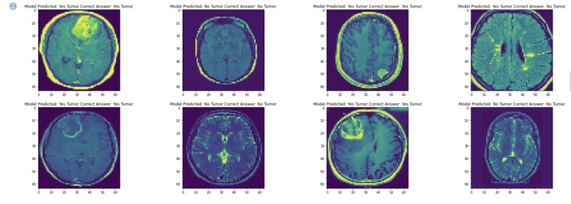 AI Disease Detection – screenshot 1