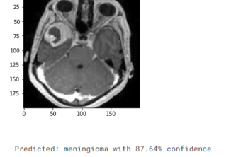 Brain MRI tumor classification