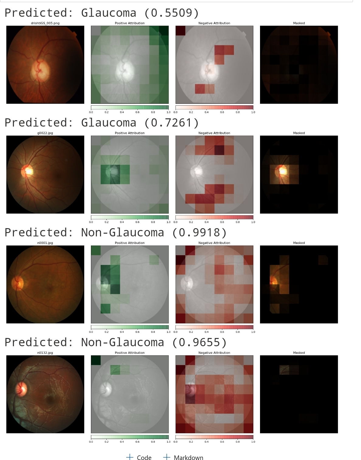 Primary Open Angle Deeplearning Assisted Diagnosis Devpost