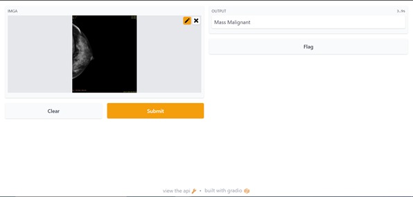 Breast Cancer Detection from Mammogram – screenshot 2