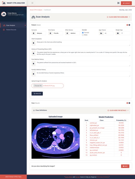 CT scan analysis by ResNet to shorten Diagnosis Time for PE – screenshot 4