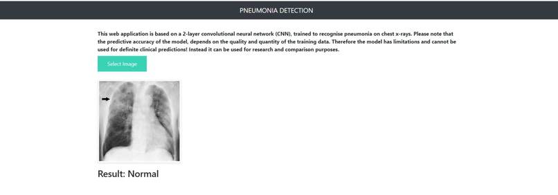 Pneumonia Identification – screenshot 3