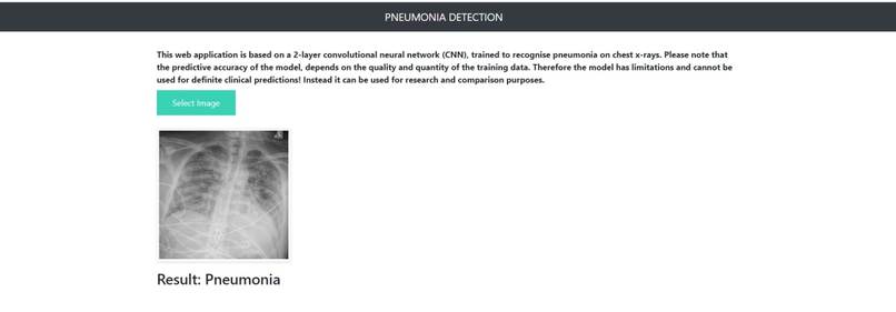 Pneumonia Identification – screenshot 4