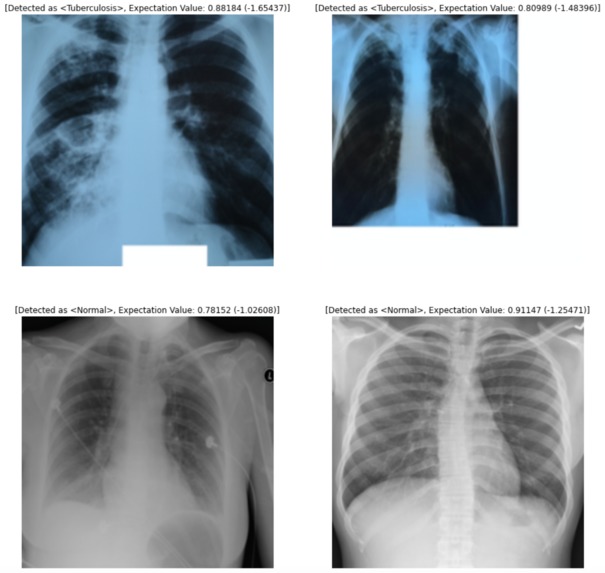 Enhancing Disease Diagnoses Machine Learning – screenshot 3