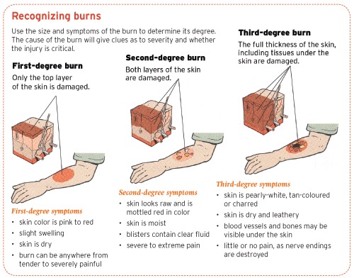 Quick Burns Assessment app – screenshot 1