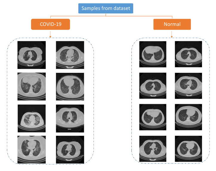 COVID detection using AI – screenshot 1
