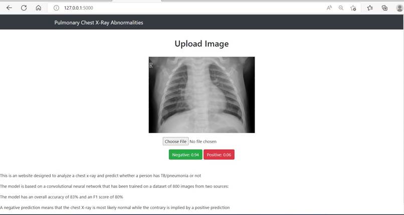 Pneumonia Prediction – screenshot 1