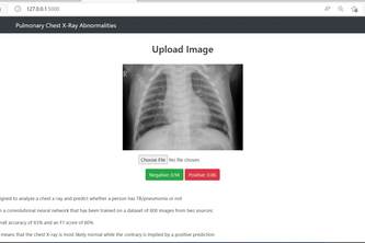 Pneumonia Prediction