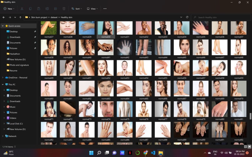 Multiclass Burn wound Classification – screenshot 2