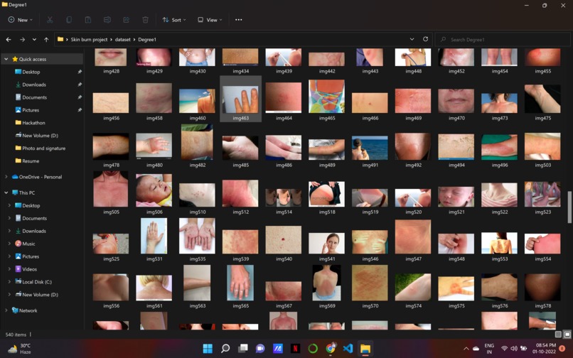 Multiclass Burn wound Classification – screenshot 3