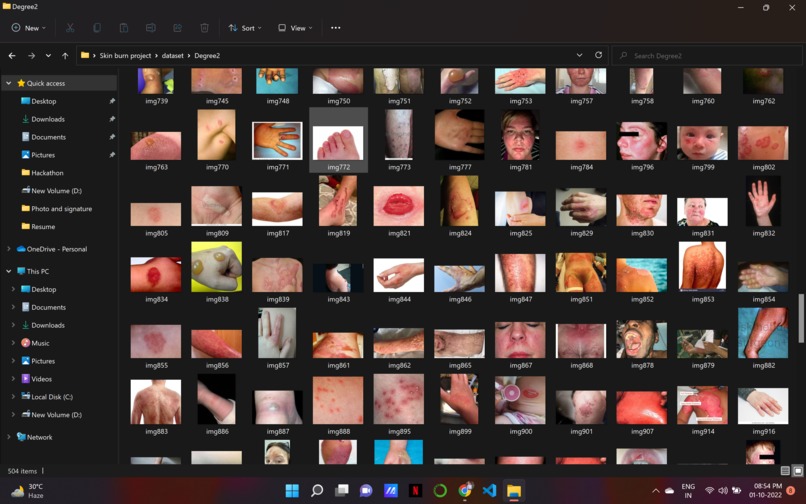 Multiclass Burn wound Classification – screenshot 4