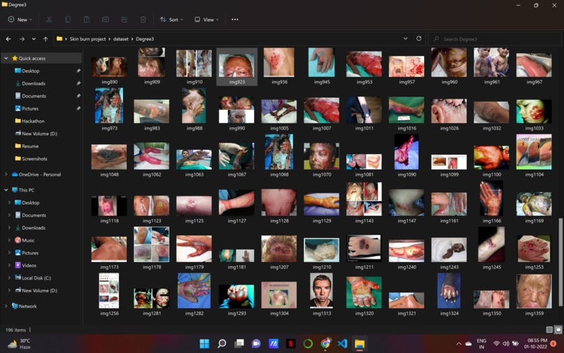 Multiclass Burn wound Classification – screenshot 5