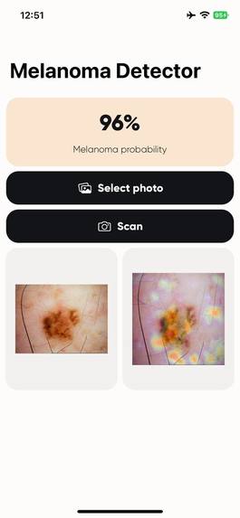 SkinSkanner – screenshot 6