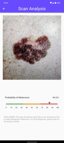 MelaScan – screenshot 5