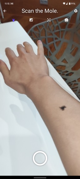 MelaScan – screenshot 3