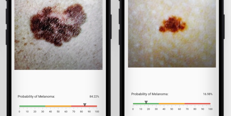 MelaScan – screenshot 6