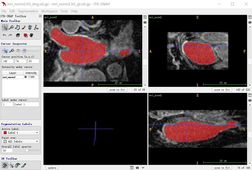 Savant’s Project – screenshot 1