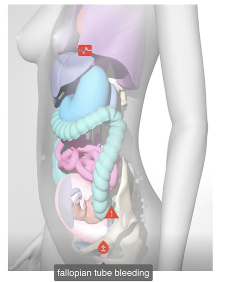 MC Render – screenshot 2