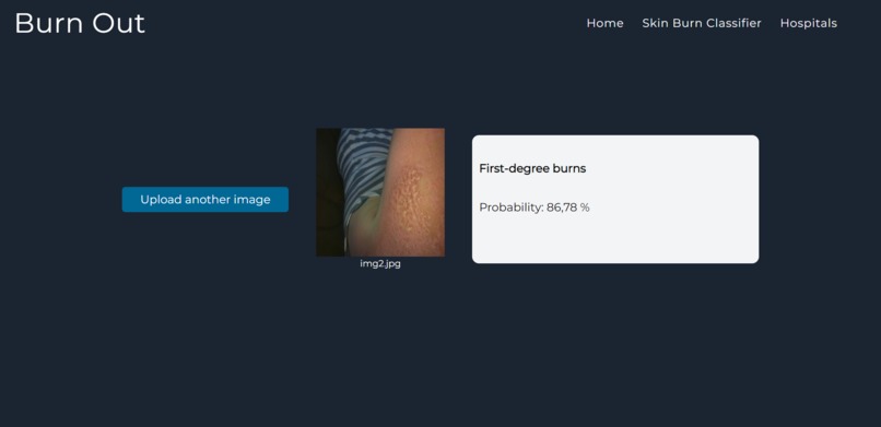 Burn Out – screenshot 3