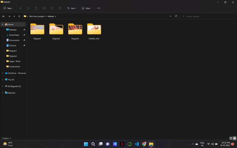 Burn 360 – screenshot 5