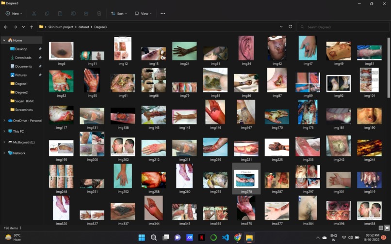 Burn 360 – screenshot 8