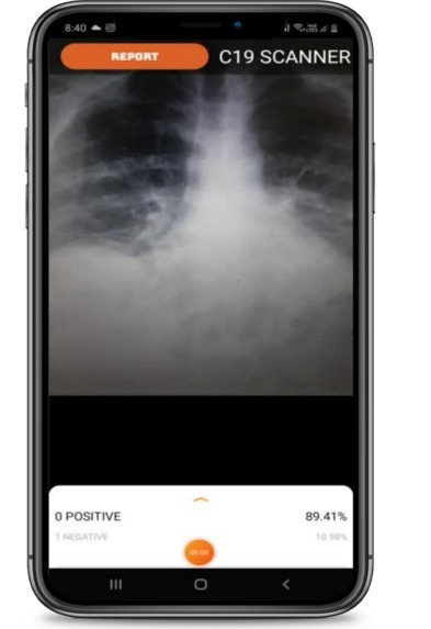 Teresa Bot – screenshot 1
