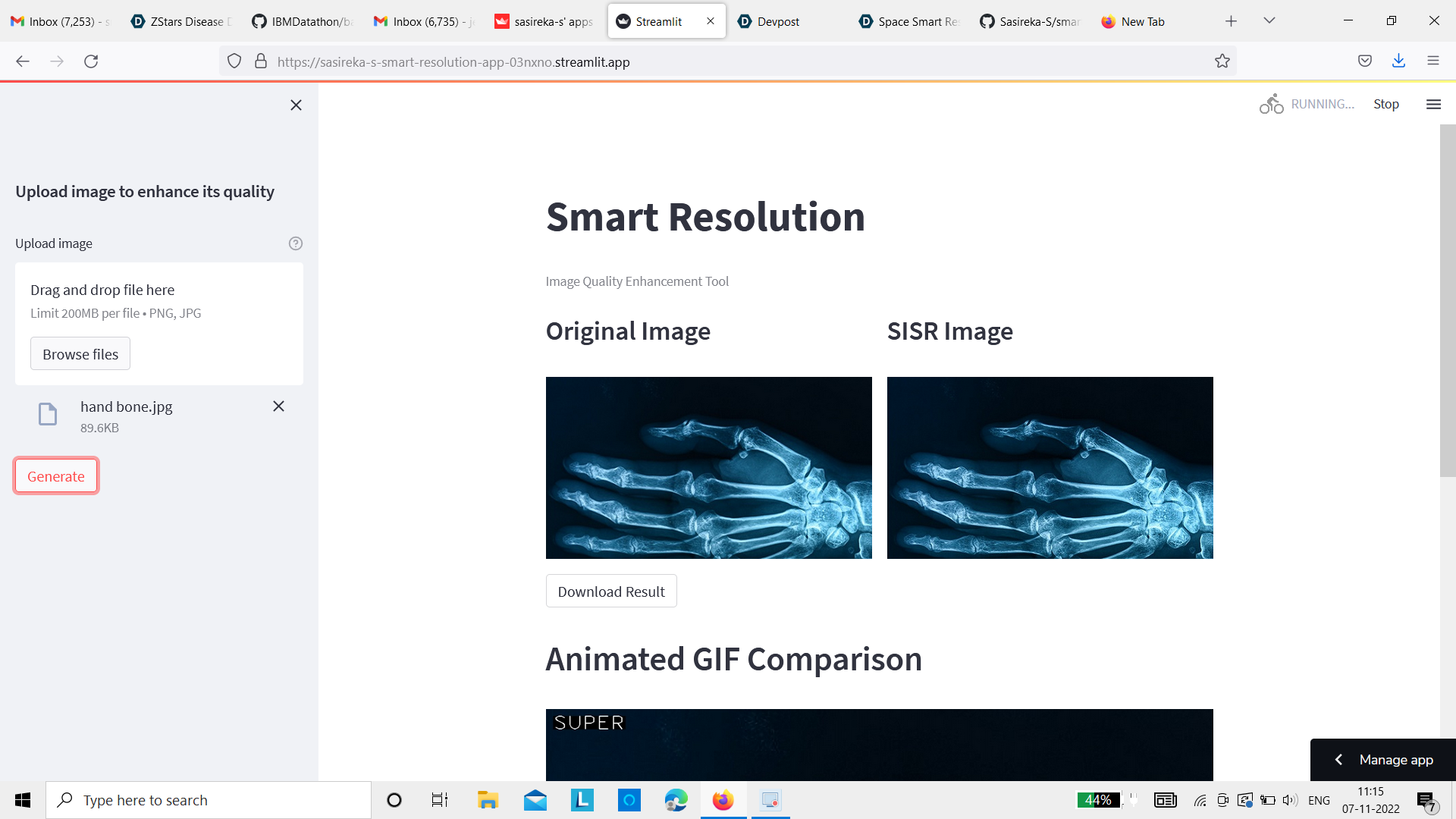 Smart Resolution Devpost