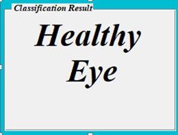 glucoma detection using emprical wavelet transform – screenshot 1