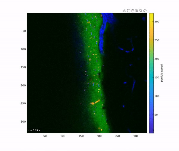 SAAIV: Reconstructing Velocity/Pressure Fields on the Brain. – screenshot 2