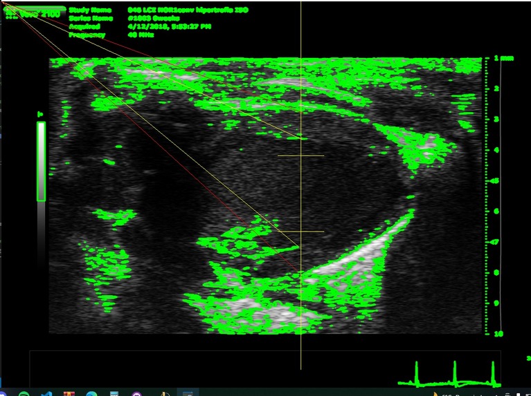 Cor al pit – screenshot 4