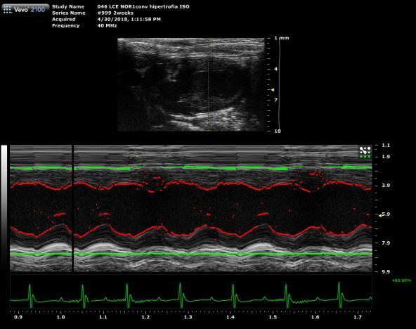 cor gran al pit – screenshot 1