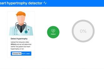Heart hypertrophy detector