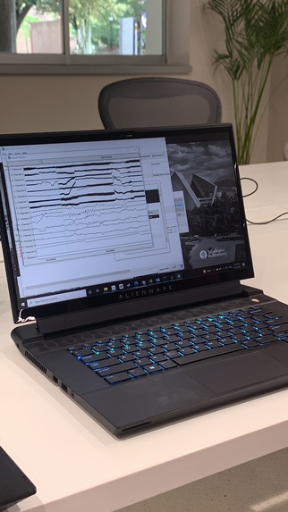 Mind-controlled prosthesis – screenshot 4