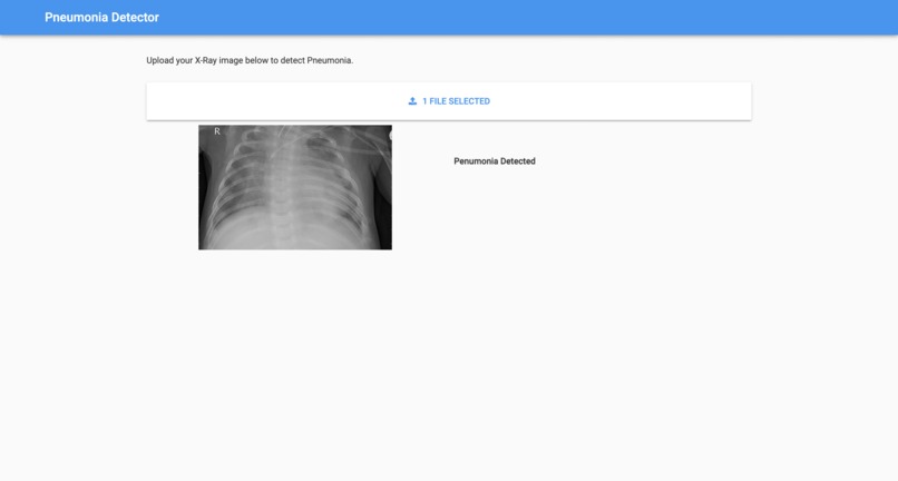pneumonia_detector-beyond – screenshot 1