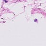 Ai-oncologist – screenshot 1