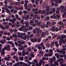 Ai-oncologist – screenshot 2