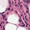 Ai-oncologist – screenshot 3