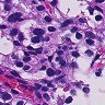 Ai-oncologist – screenshot 6