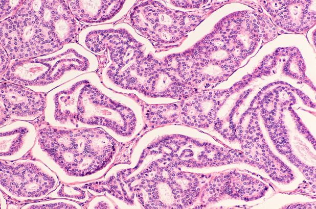 Ai-oncologist – screenshot 9
