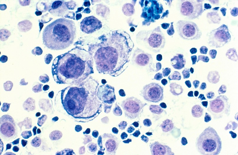 Ai-oncologist – screenshot 12