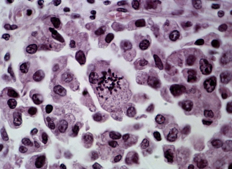 Ai-oncologist – screenshot 13