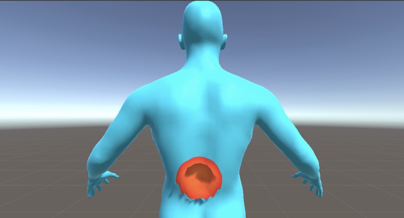 PainPal – screenshot 2