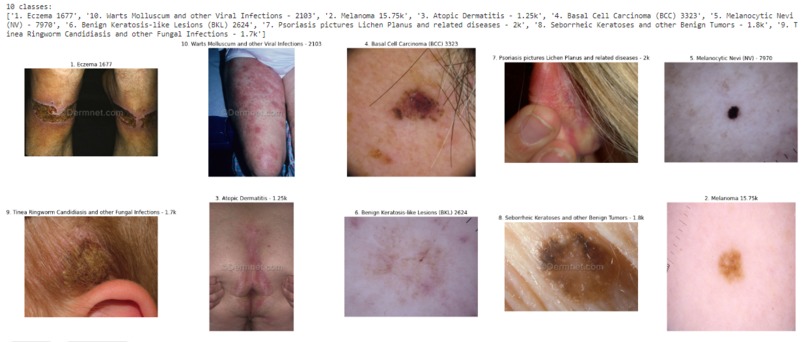 Do U haVe sKin DiSeasE? – screenshot 9
