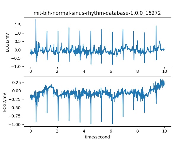 Delving deep into ECG signal quality assessment  – screenshot 2