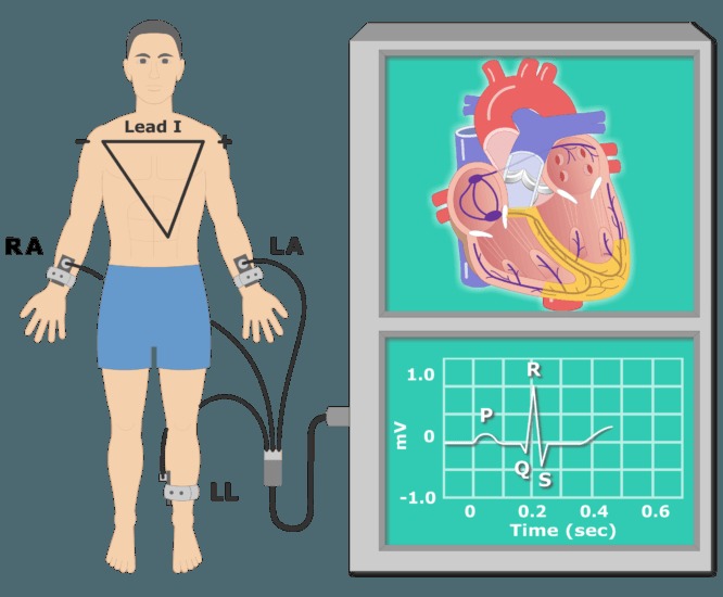 Delving deep into ECG signal quality assessment  – screenshot 1