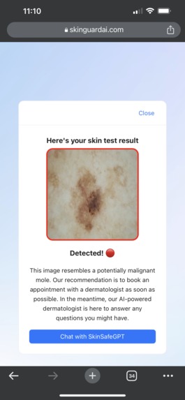 SkinGuardAI: Detect skin cancer early using your phone – screenshot 2