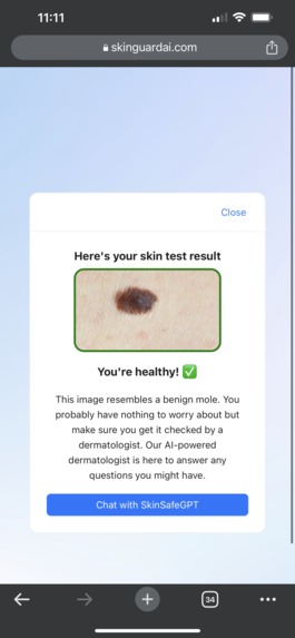 SkinGuardAI: Detect skin cancer early using your phone – screenshot 3