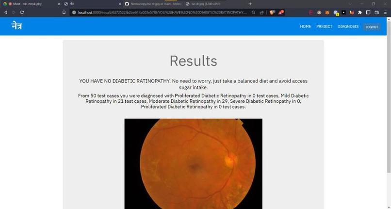 Netra – screenshot 3