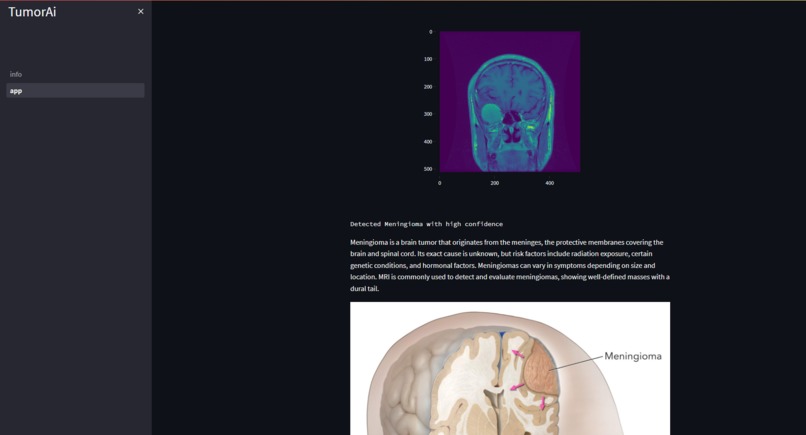TumorAi – screenshot 1