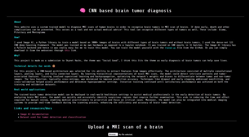 CNN based brain tumor diagnosis – screenshot 1